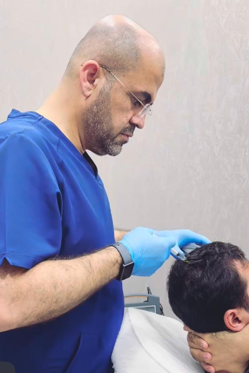 Hair density before and after PRP therapy