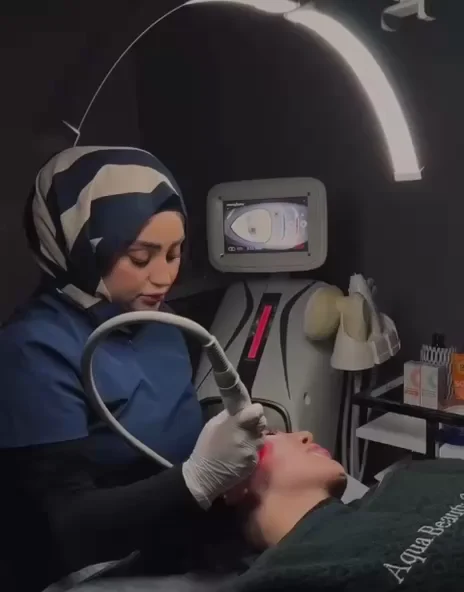 HIFU facial treatment